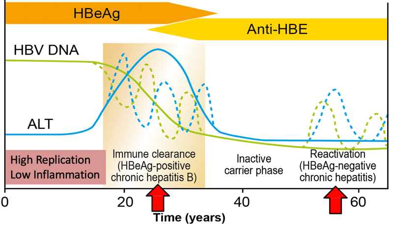 chronic hepatitis b infection with high hbv dna and normal alt to treat or not to treat dr gish